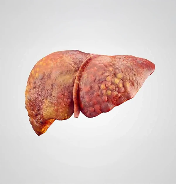 Ilustração de fígado saudável vs gorduroso
